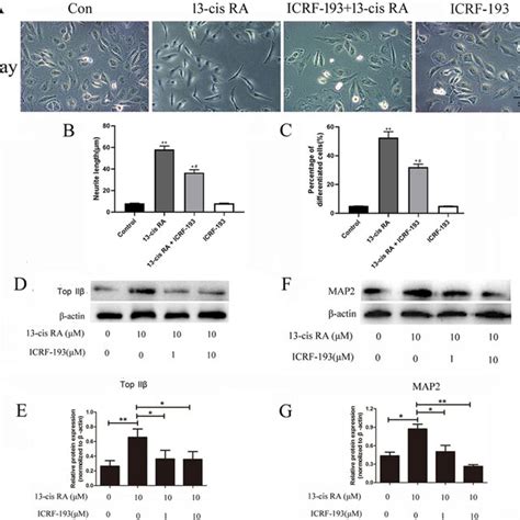 ICRF 193 inhibited neurite outgrowth and the expression of Top IIβ and