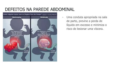 Exame F Sico E Avalia O Inicial Do Rec M Nascido Ppt