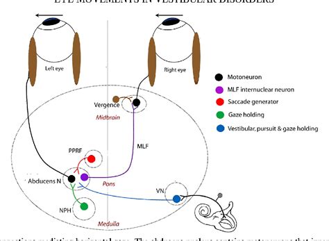 Figure From Eye Movements In Vestibular Disorders Semantic Scholar