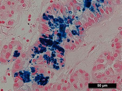 VitroView™ Prussian Blue Stain Kit