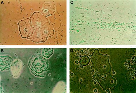 Wet Mount Microscopy Reflects Functional Vaginal Lactobacillary Flora