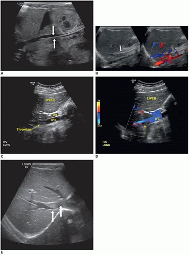 The Pediatric Abdomen Radiology Key