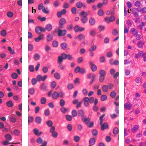 Morhometric Analysis Of The Mouse Adrenal Cortex After Exercise Download Scientific Diagram