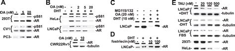 Androgen Receptor Phosphorylation and Activity Are Regulated by an Association with Protein ...