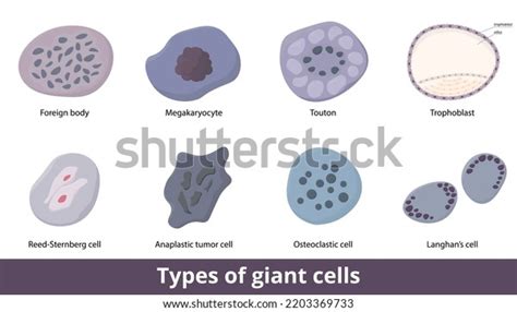 23 Giant Cell Tumor Stock Vectors, Images & Vector Art | Shutterstock