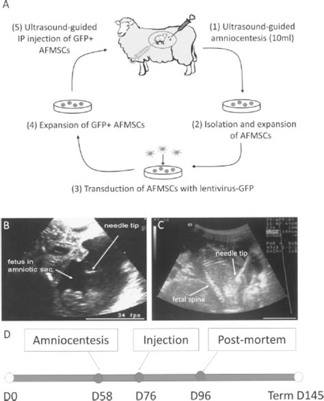 Experimental design and injection procedure. After amniocentesis ...