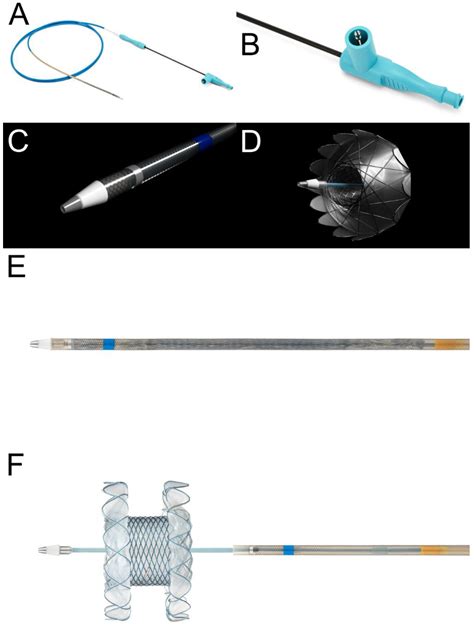 Jcm Free Full Text Placement Of Plastic Stents After Direct