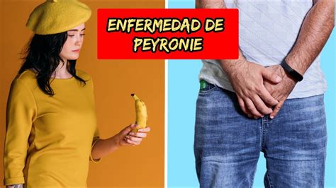 Incurvacion Del Pene O Enfermedad Peyronie Youtube