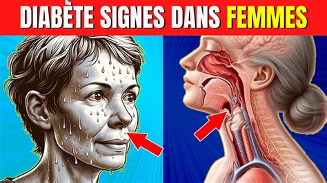 10 Signes Courants Du Diabète Chez Les Femmes Symptômes Du Diabète