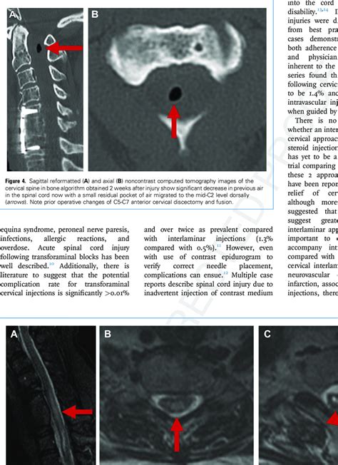 Sagittal Short Tau Inversion Recovery A And Axial T2 Weighted Bc