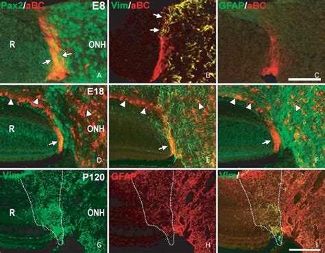 Pax Vimentin And Glial Fibrillary Acidic Protein Gfap Expression