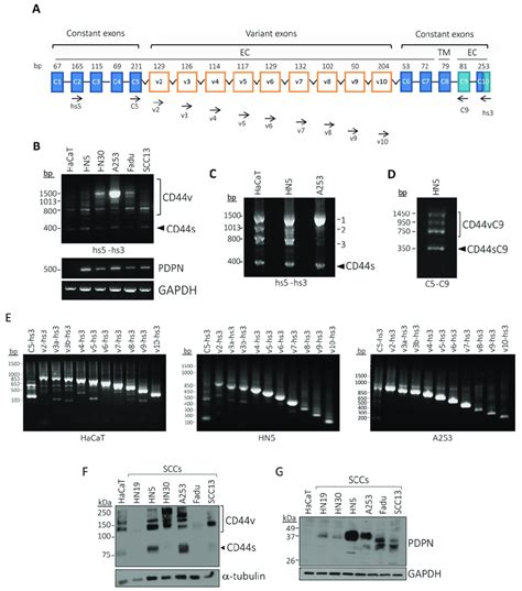 Podoplanin Is Co Expressed With Cd V And Cd S Isoforms In Human Scc