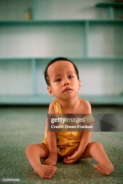 128 Deformed Baby Stock Photos, High-Res Pictures, and Images - Getty Images