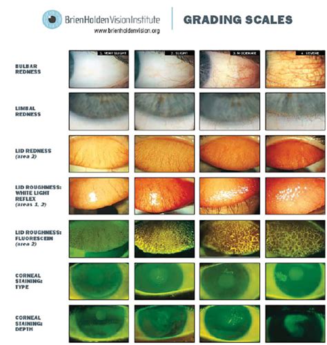 Understand How To Work Grading Scales