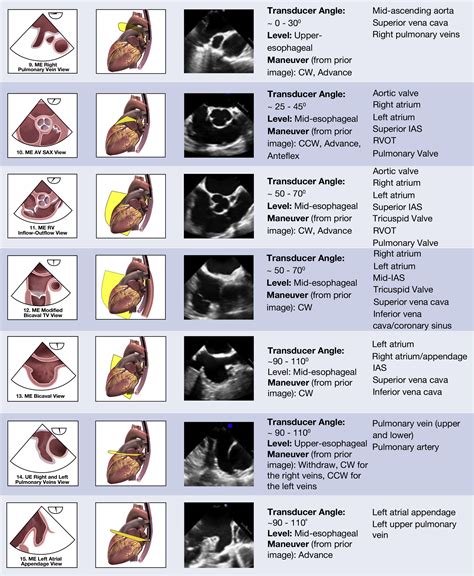 Guidelines For Performing A Comprehensive Transesophageal