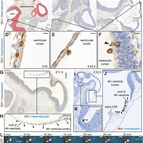 Csf R Fire Fire Mice Lack Intracerebroventricular And Chp