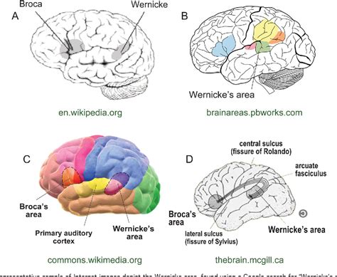 Figure 1 from The Wernicke area | Semantic Scholar