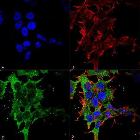 Anti Gaba B Receptor 2 Antibody S81 2 Monoclonal Igg1