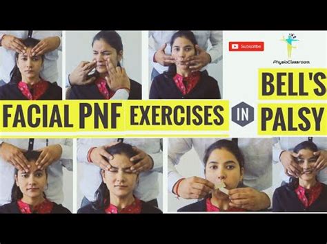 Facial Pnf Exercises In Bell S Palsy Youtube