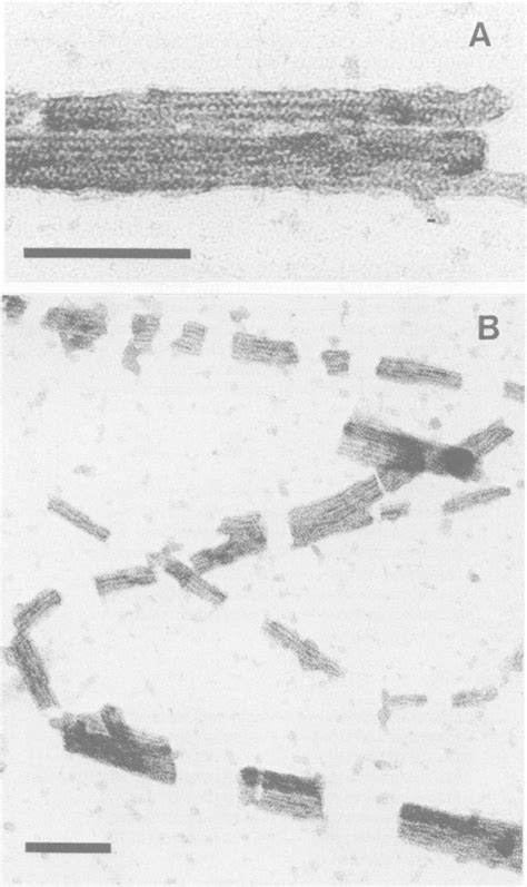 Electron Micrographs Of Negatively Stained Actin Filament Bundles