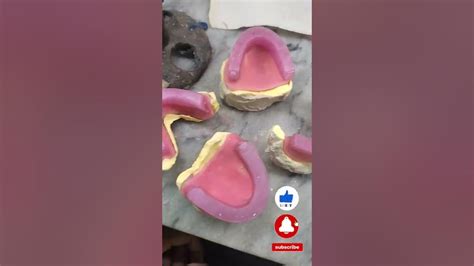 Complete Denture Bite Complete Denture Jaw Relation Bite