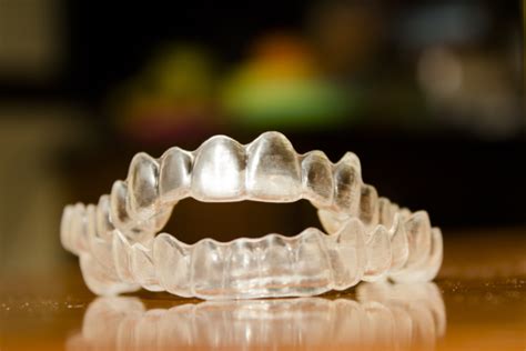 Orthodontic Retainers Atria City Dental Group