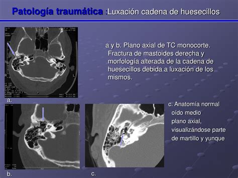 Ppt Papel Del Tcmd En El Diagn Stico De La Patolog A De O Do