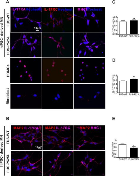 Immunostaining Of The Il 17 Receptor Il 17ra And Il 17rc And Mhci In