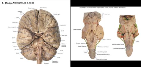 Week 21 Brainstem Cranial Nerves And Vision Diagram Quizlet