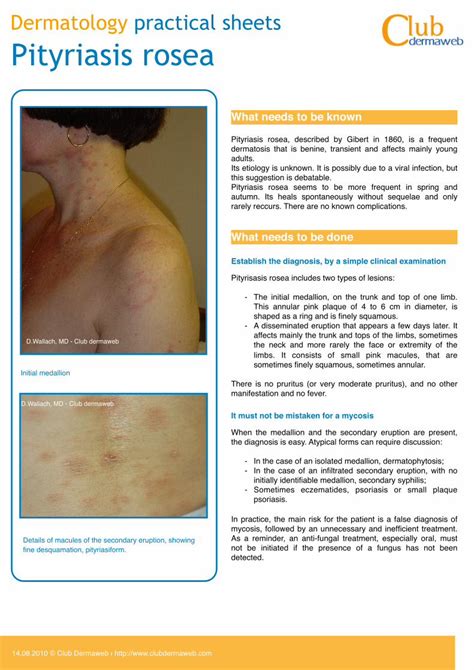 Pdf Dermatology Practical Sheets Pityriasis Roseacdn1dlclubdermaweb