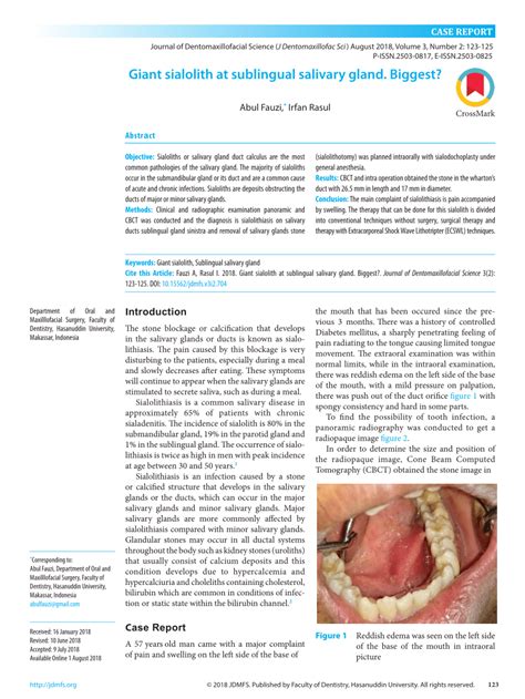 PDF Giant Sialolith At Sublingual Salivary Gland Biggest