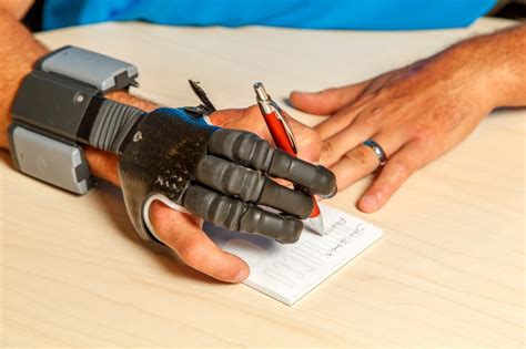 Prosthetic Technology Arm Dynamics