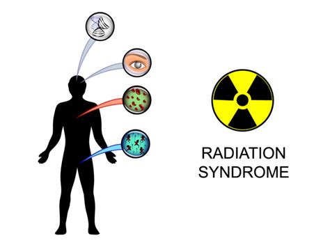 Rncp Selects Redhills Opaganib For Evaluation For Acute Radiation