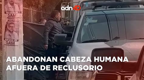 Como Si Fuera Cualquier Cosa Abandonan Cabeza Humana Afuera De