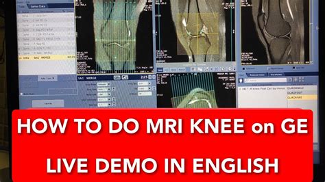 Knee Joint MRI Scan Protocol Positioning And Planning On GE 1 5 Tesla