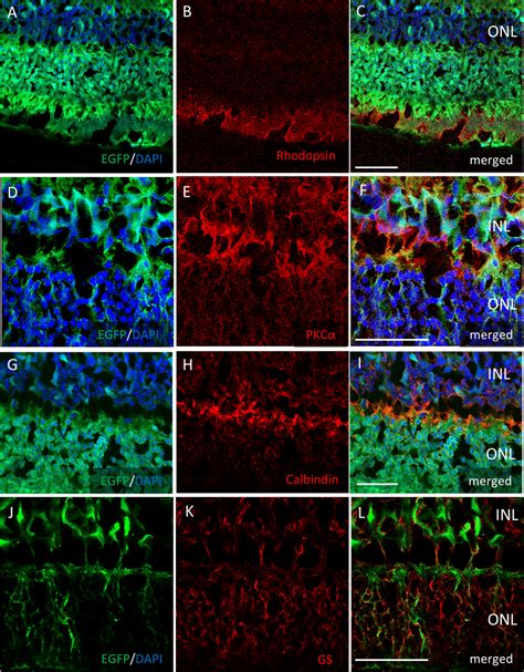 Immunostaining Of Each Retinal Cell Type Of Aav Dj Intravitreally