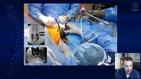 Transcending Minimally Invasive Lateral Spine Surgery Grand Rounds