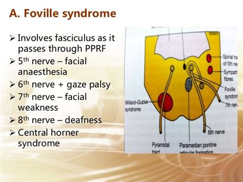 Abducens Nerve - Course and relation.