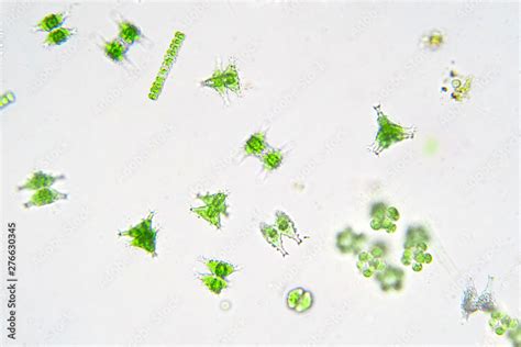 Freshwater aquatic plankton under microscope view. Stock Photo | Adobe ...