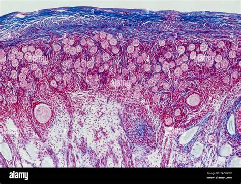 Ovarian Follicles Light Micrograph Of A Sectioned Ovary Showing The