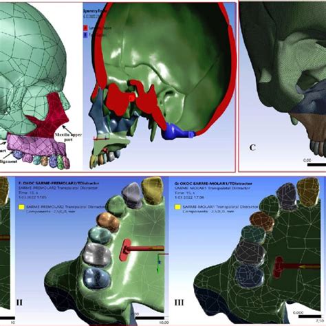 A Symmetrical Model Of Craniofacial Structures B Screw Moved 25 Mm Download Scientific