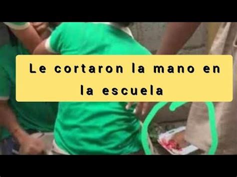 Le Cortan La Mano A Un Adolecente En Una Escuela En San Pedro De