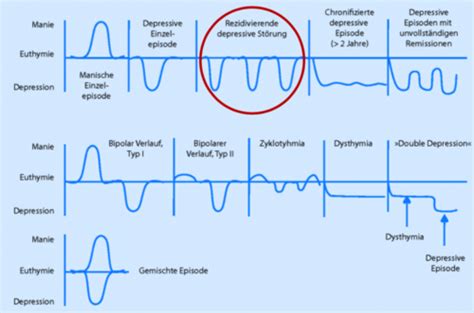 Depression Suizidalit T Affektive St Rungen Flashcards Quizlet