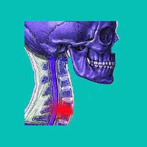 Bulging Disc Treatments - Herniated Disc