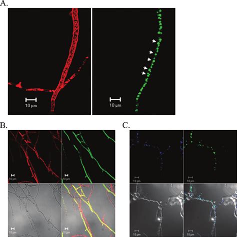 Subcellular localization of EGFP fused to Ver-1 in AF and EGFP ... 