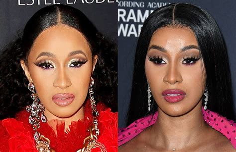 Cardi B Nose Surgery Remedy Istanbul