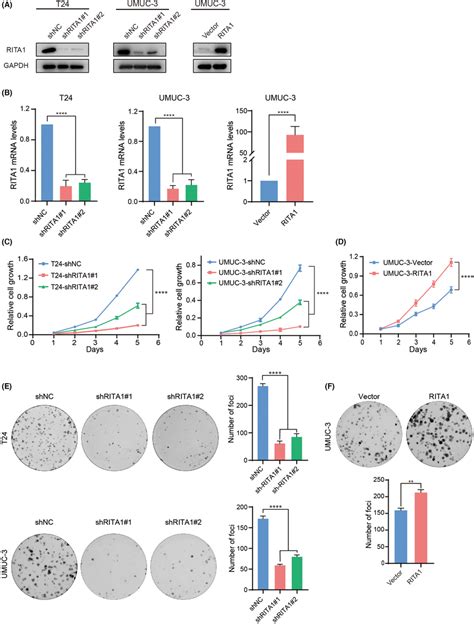 Rita1 Promotes The Growth Of Bladder Cancer Bc Cells A The