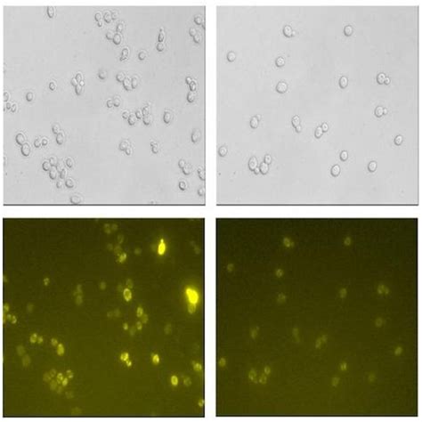 Using Yeast to Synthesize Incredible new Drugs | Cell And Molecular Biology 