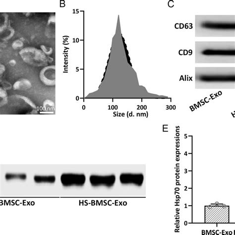 Identification Of Bmscs Derived Exosomes Transmission Electron Download Scientific Diagram