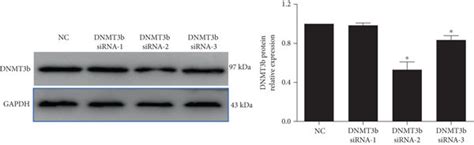 Silencing Dnmt B Attenuated Ox Ldl Induced Macrophage Inflammatory